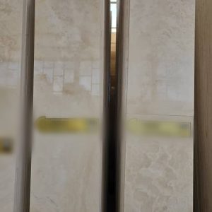 تراورتن عباس آباد